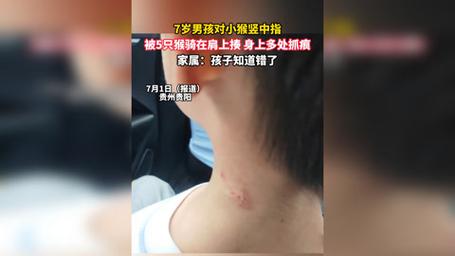 新澳門4949最新開獎記錄和對小猴豎中指被追打與對猴子豎中指