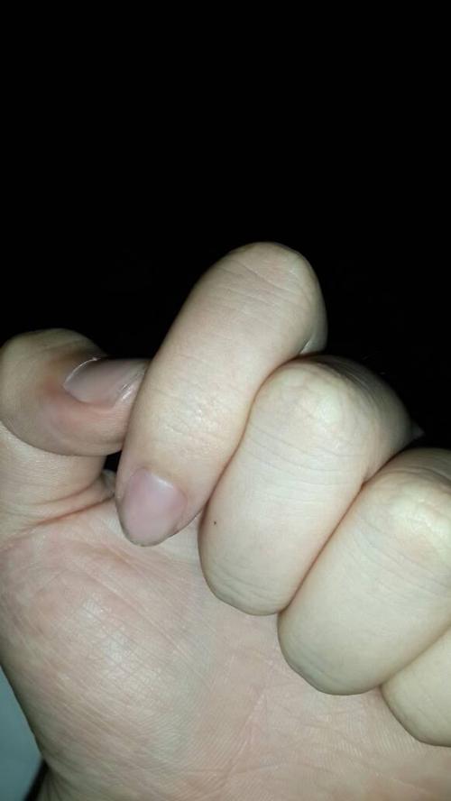 新門內(nèi)部資料最快更新和住全季半夜被老鼠咬與半夜被老鼠咬會(huì)不會(huì)痛醒